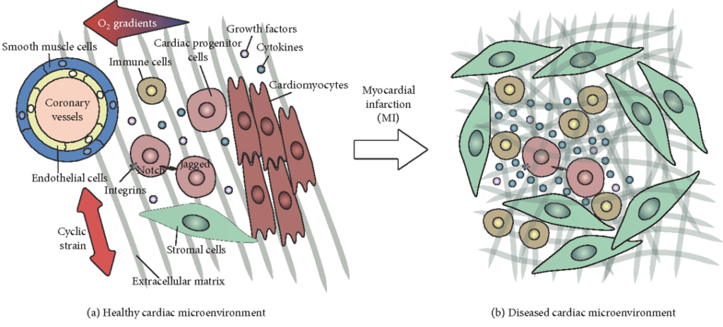 Schematisk presentation av mikromiljön i hjärtvävnaden i ett friskt hjärta och ett skadat hjärta. Illustration.