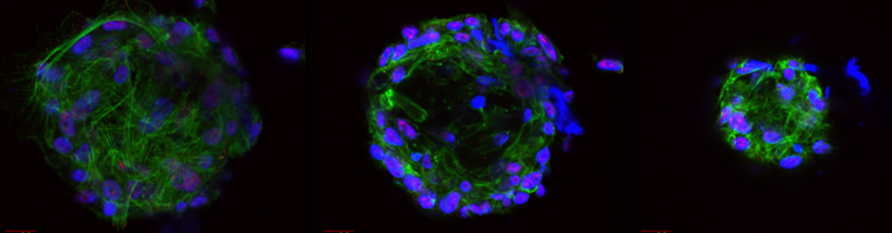 Bild av hjärtvävnad taget med ett konfokalmikroskop av en tredimensionell mini­vävnad av regenerativa celler. Blålila prickar på gröna linjer.