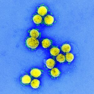 Virus particles pictured as yellow circles with small green "arms" on a blue background.