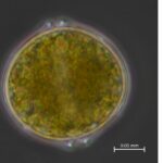 Bild via mikroskop på algen A. ostenfeldii.