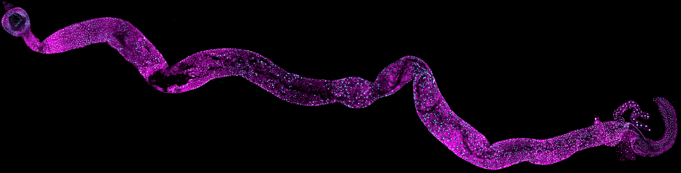 Mikroskopbild från Inflammatory Signalling Lab:s forskning.