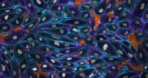 mikroskopbild av celler