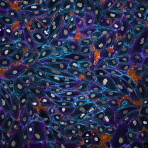 mikroskopbild av celler