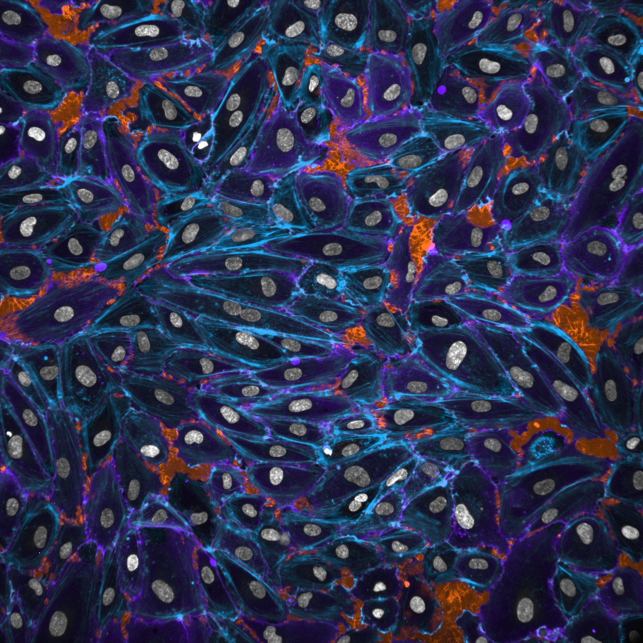 mikroskopbild av celler