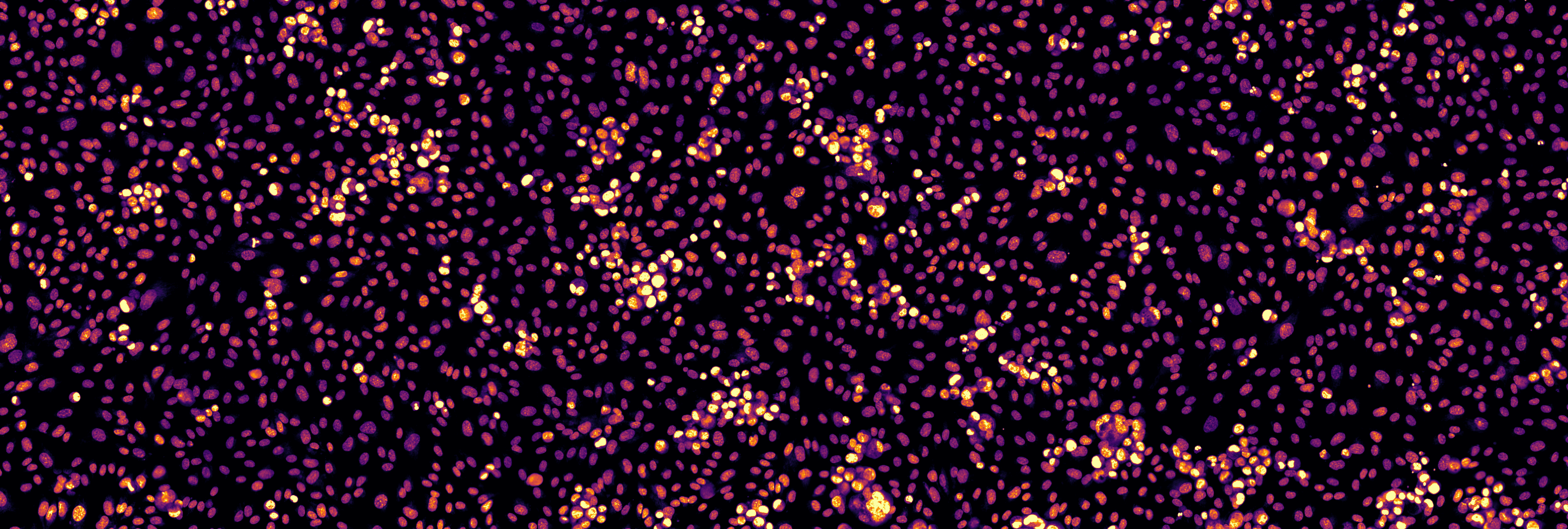 From Star Charts to Microscopes: New Tool Solves Imaging Challenges with The Help of Astronomy